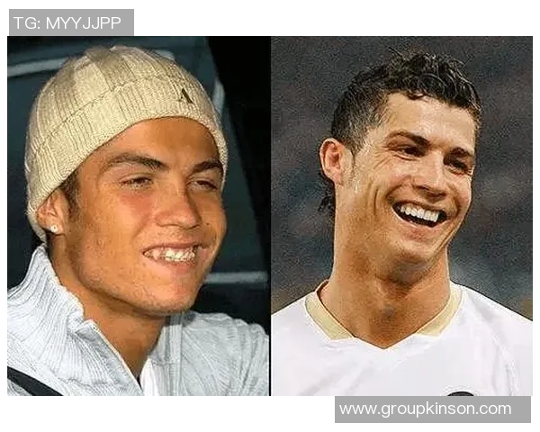 足球明星正畸前后对比照揭秘他们的笑容变化与成长历程 足球明星正畸前后对比照揭秘他们的笑容变化与成长历程